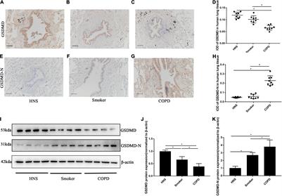 Transient Receptor Potential Cation Channel Subfamily V Member 4 Mediates Pyroptosis in Chronic Obstructive Pulmonary Disease